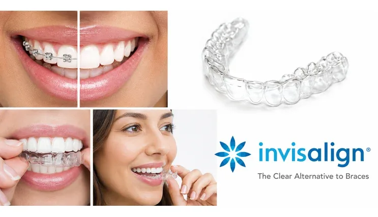 Invisalign clear aligners shown on smiling patients, with the Invisalign logo