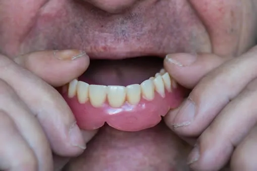 Man putting dentures in mouth