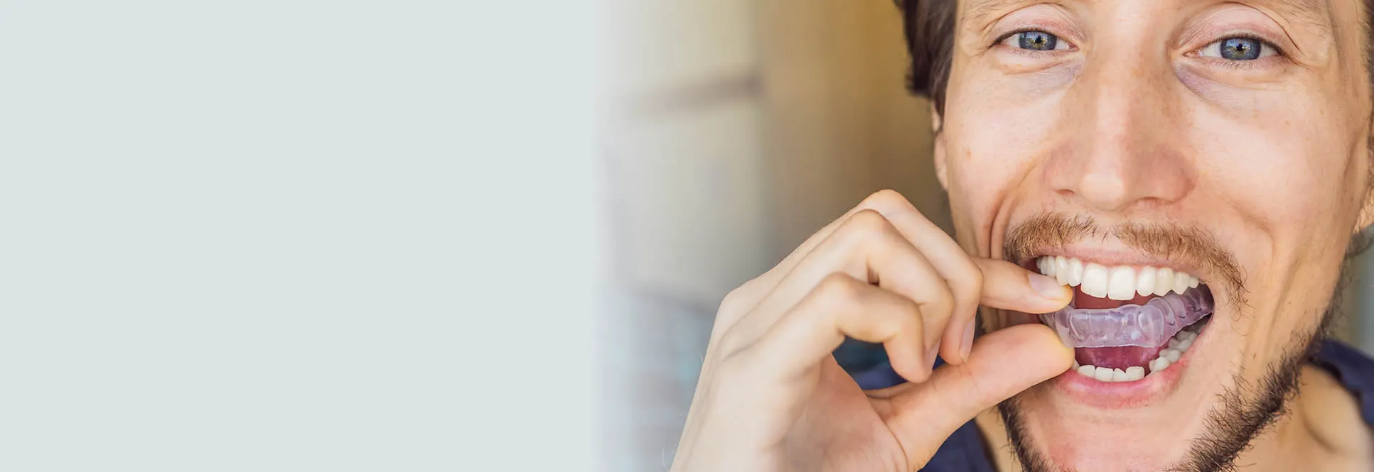 Teeth grinding mouth guard at Village Dental Kogarah