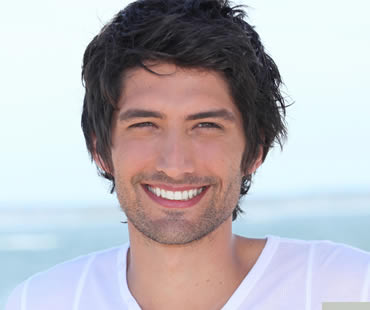 Veneers for teeth