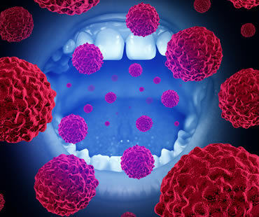 oral cancer screening