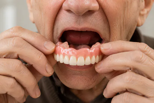 complete denture complete dentures