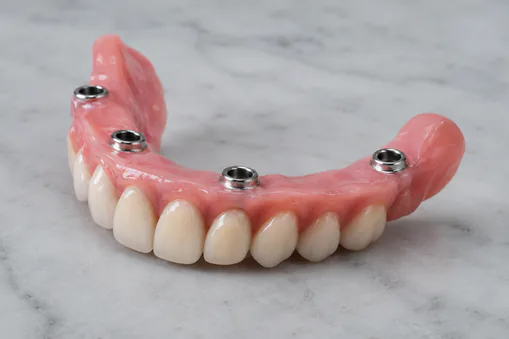 snap denture Snap in dentures