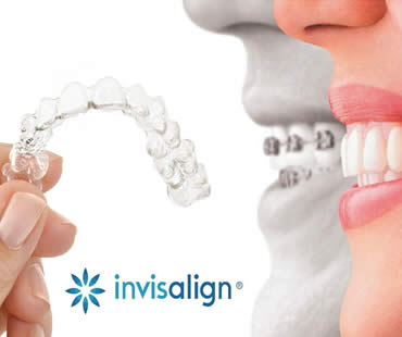 Invislaign in Ryde, Campsie, Kogarah, and Haymarket